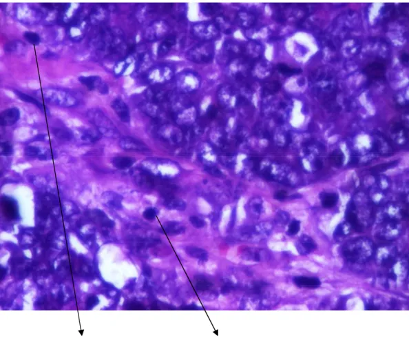 Gambar  11 : Sebukan limfosit dan makrofag pada kelompok perlakuan  P1                       (Pembesaran 400 X) 