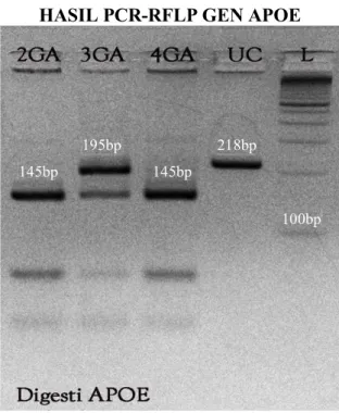 Gambar 15 . Hasil pemeriksaan genotip gen ApoE dengan tekhnik PCR-RFLP  Kolom L (Ladder DNA) berfungsi sebagai penanda letak basepair (bp)