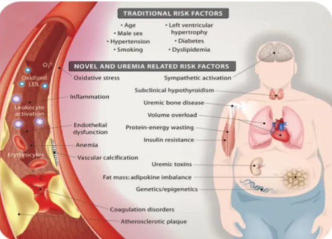 Gambar  2.2  Faktor  resiko  kardiovaskuler  tradisional  dan  non  tradisional  (terkait  uremia)  pada  Penyakit  Ginjal  Kronik  (Stevinkel,  2008) 