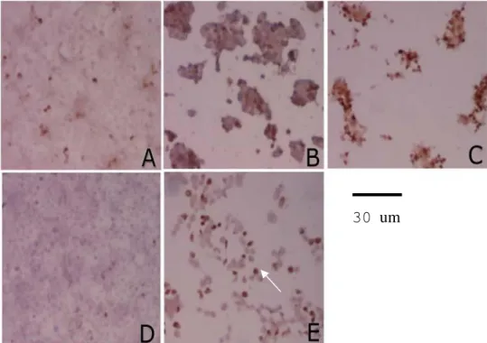 Gambar  1.  Imunohistokimia  sel  WiDr  dengan  antibodi  anti-  caspase-3   aktif.   Sel   difiksasi   48   jam  setelah   perlakuan