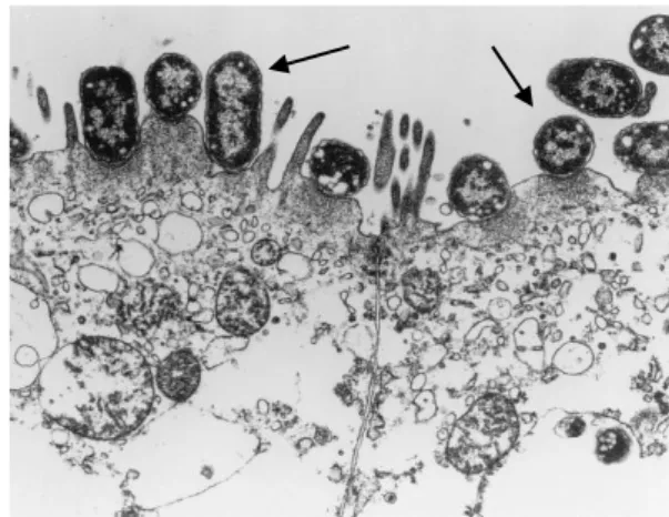 Gambar  2  Perlekatan  EPEC  (panah)  pada  membran  enterosit  dengan  kerusakan  pada sitoskeleton apikal (Nataro dan Kaper 1998) 