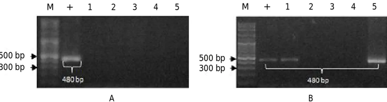 Gambar 2. Deteksi transgen (krt-GP11) pada benih ikan mas transgenik F-2; A) populasi F 2 B#1 dan B) populasi F 2 B#2; M= marker DNA; (+)= kontrol positif plasmid; 1-5= sampel benih ikan mas transgenik F-2