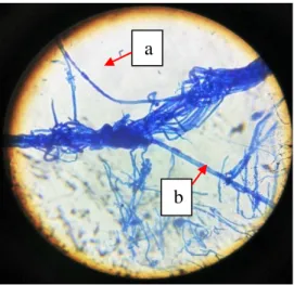Gambar  3.  Aktifitas  mikoparasit  pada  Ganoderma  sp.  oleh  Trichoderma  sp1.  dengan  perbesaran  400x