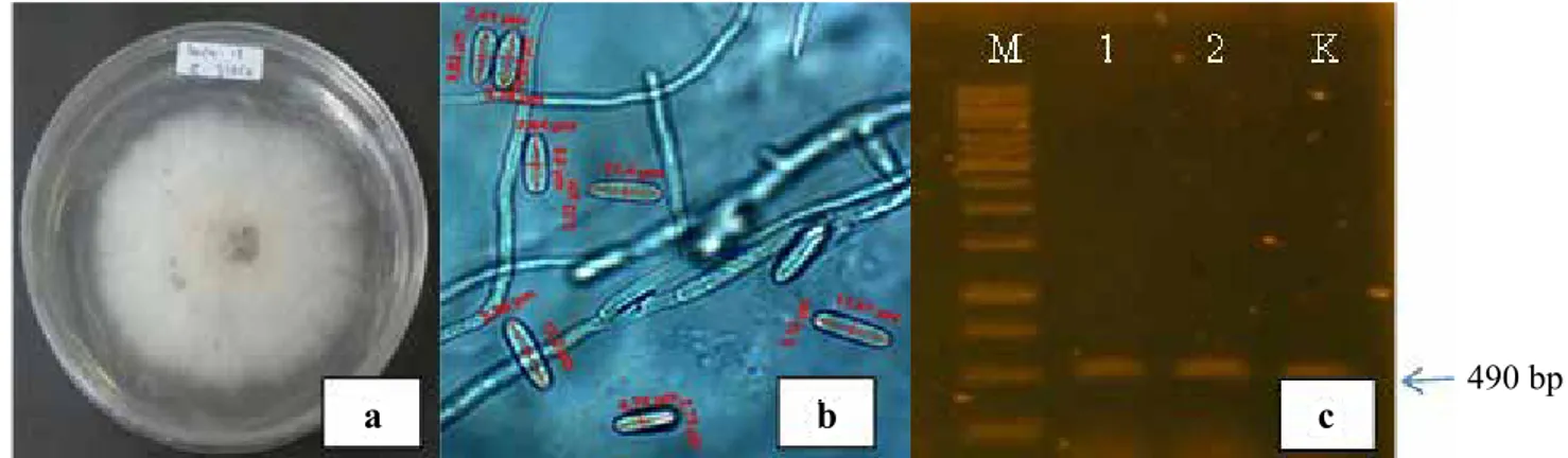 Gambar 1. (a) Koloni C. acutatum pada media PDA, (b) konidia C. acutatum (perbesaran 1.000x), (c)  elektroforesis  DNA C