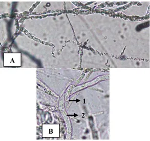 Gambar  5.  Hasil  uji  antagonis  secara  in- in-vivo pada batang tanaman lada,  A. kontrol, B