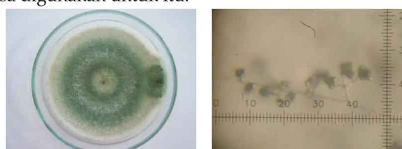 Gambar 1. Penampilan Makro dan Mikroskopis Trichoderma sp. 