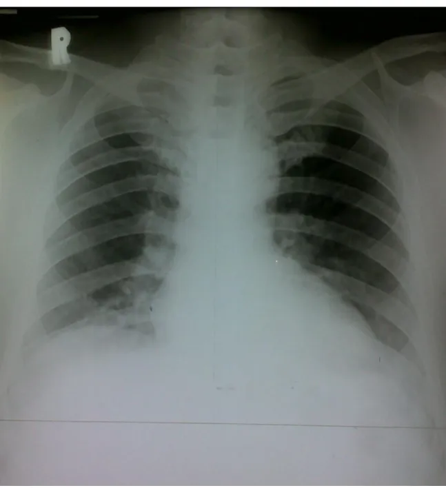 FOTO THORAX 