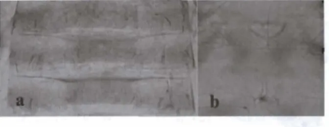 Gambar 10  Posisi stenidia pada Tergit Abdomen VIII (a)  di Belakang Spirakel, (b) di Depan Spirakel 
