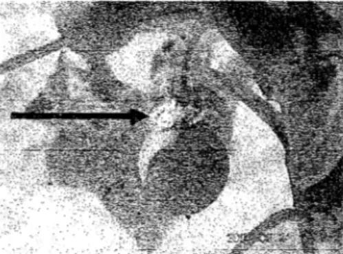 Gambar 4.  Ferrisia virgata 