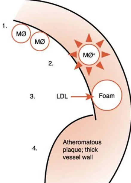 Gambar 3. Patogénesis aterosklerosis (Mealey, et al. 2006).