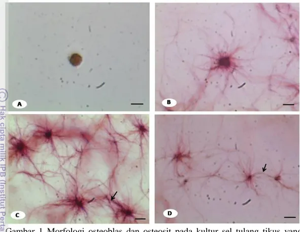 Gambar  1  Morfologi  osteoblas  dan  osteosit  pada  kultur  sel  tulang  tikus  yang  diwarnai dengan Alizarin red