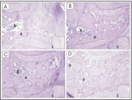 Gambar 1.   Histopatologi struktur trabekula pada potongan memanjang tulang mandibula  dengan pewarnaan HE (Perbesaran 100X) 