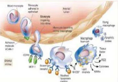 Gambar 2.1: Fagosit mononuclear pada aterogenesis. (Libby, 2002) (12 )