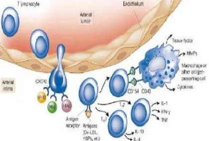 Gambar 2.3 Peran Limfosit T dalam aterogenesis.( Libby 2002) (12 )