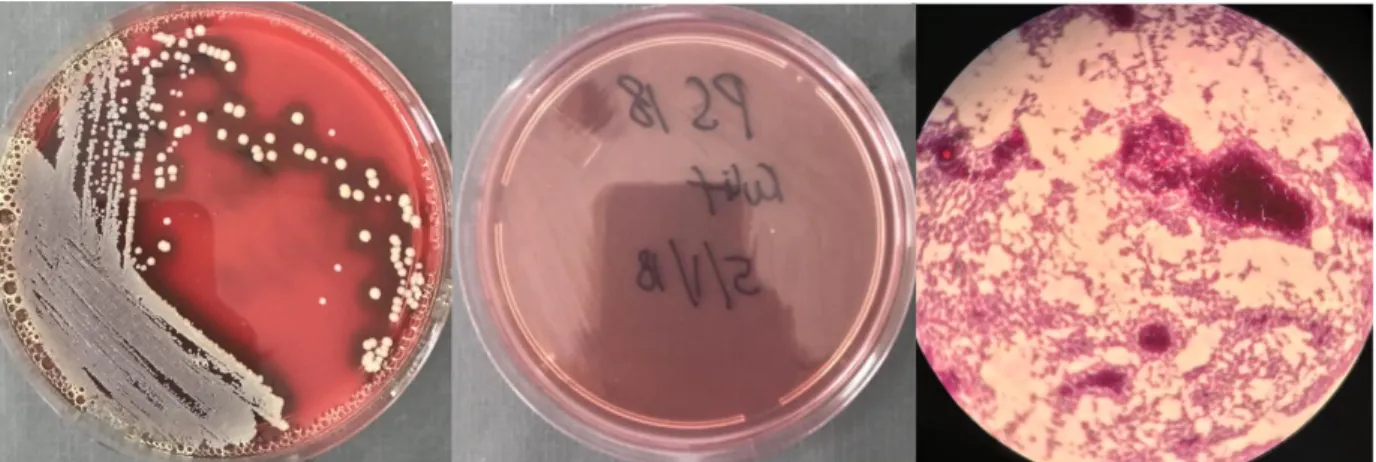 Gambar 5. (a) Media blood agar yang terdapat pertumbuhan bakteri (b) Media MacConkey yang  tidak ditumbuhi bakteri (c) Hasil pengecatan gram ke-2 yang diambil dari biakan bakteri pada 