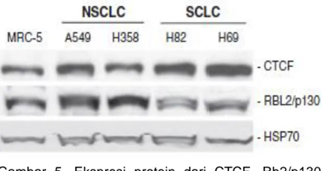 Gambar  5.  Ekspresi  protein  dari  CTCF,  Rb2/p130  (RBL2/p130)  pada  nonimmortalized  lung  fibroblast  (MRC-5),  pada  sel  A549  dan  H358  (NSCLC),  dan  pada H82 dan H69 (SCLC)