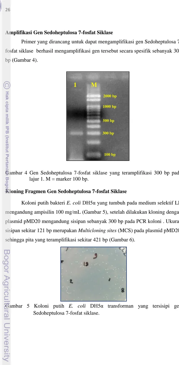 Gambar  4  Gen  Sedoheptulosa  7-fosfat  siklase  yang  teramplifikasi  300  bp  pada  lajur 1