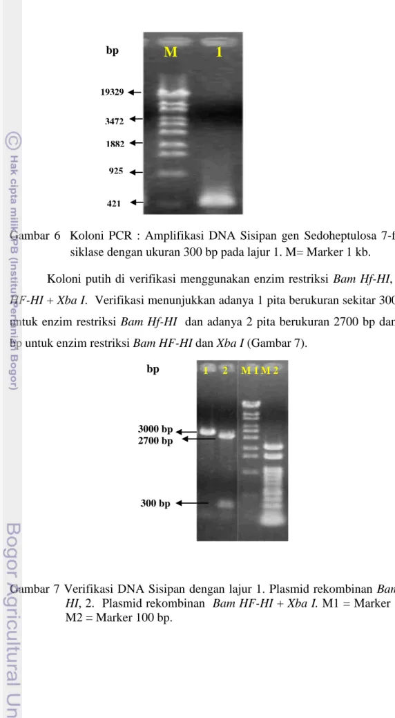 Gambar  6    Koloni  PCR  :  Amplifikasi  DNA  Sisipan  gen  Sedoheptulosa  7-fosfat  siklase dengan ukuran 300 bp pada lajur 1