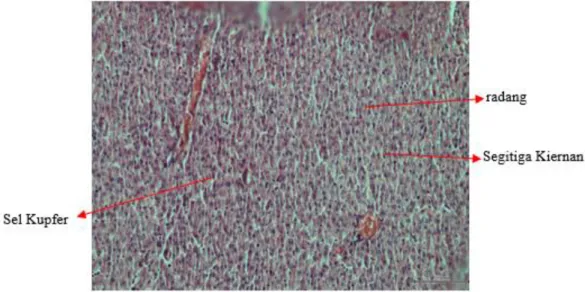 Gambar 1. Sel hepatosit dengan perbesaran 10x, kelompok kontrol Positif, ada radang tetapi lebih  banyak sel Kupfer, degenerasi tidak ada, nekrosis tidak ada