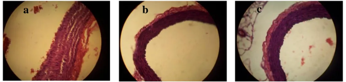 Gambar  2.  Penampang  aorta  tikus  hasil  pengecatan  HE:  kelompok  kontrol  positif  (a),  kelompok kontrol negatif (b), kelompok natto kacang inferior (kacang otok) (c) 
