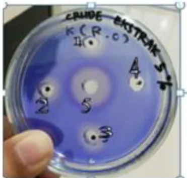 Gambar  3.  Hasil  uji  fibrin  plate  ekstrak  kasar  tempe  Canavalia  ensiformis  hasil  fermentasi  Rhizopus  oryzae  FNCC  6078,  dimana  (1)  Sampel  ekstrak  kasar  1  (2)    Sampel  ekstrak  kasar  2  (3)  Sampel ekstrak kasar 3 (4) Kontrol negatif