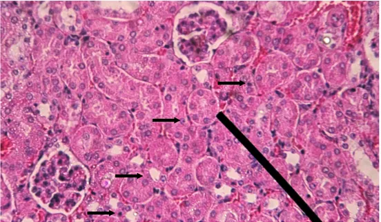 Gambar 3. Degenerasi albuminosa pada sel tubulus proksimal pembesaran 400x. 