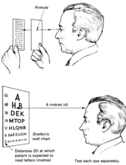 Tabel Snellen 