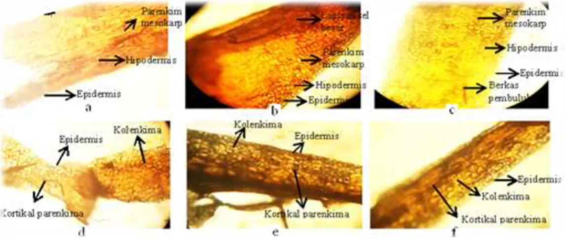 Gambar  1.  Hasil  pemeriksaan  anatomi  buah  cabe  rawit  hiyung  (Perbesaran  10x10)
