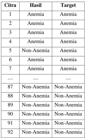 Tabel 1. Contoh Hasil Identifikasi Anemia  dan Non-Anemia berbasis Citra Sel Darah 