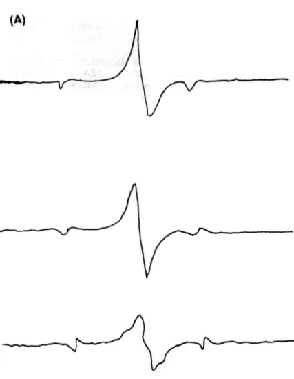 Gambar 2.  Spektrulll ESR biji  Pulasari Imsil iradiasi pada dosis (A)  10 kGy  (B) 20 kGy  (C) 30 kGy