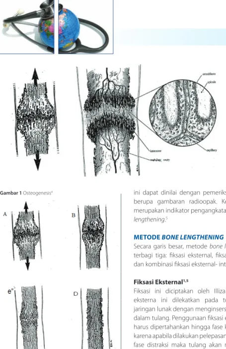 Gambar 1 Osteogenesis 4