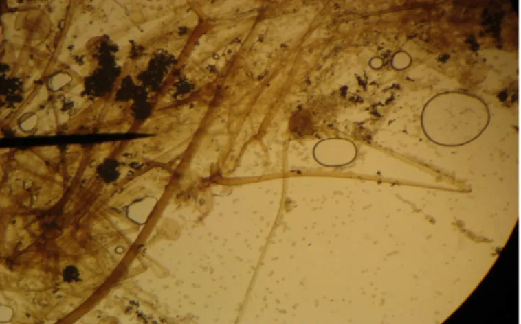 Gambar 8. Mikroskopis R. oryzae pada perbesaran 100×
