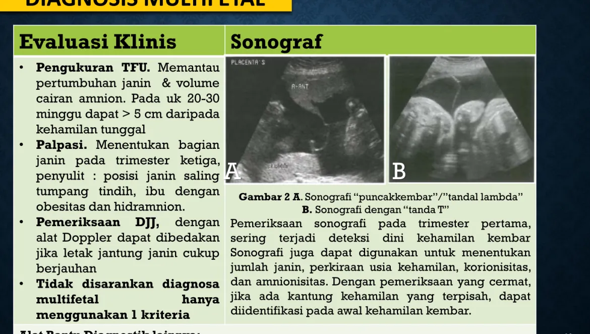 Gambar 2 A. Sonografi “puncakkembar”/”tandal lambda”  