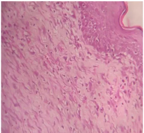 Gambar 1.Gambaran histopatologiskulit  tikus K1 dengan pewarna H.E  (perbesaran 400 kali, potongan  melintang)