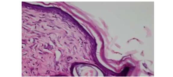 Gambar 1.     Gambaran histopatologis kulit tikus K1 dengan pewarna H.E (perbesaran 400  kali, potongan melintang)