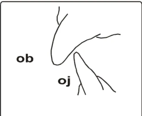 Gambar  4 : oj: overjet (jarak gigit)           ob: overbite (tumpang gigit) 