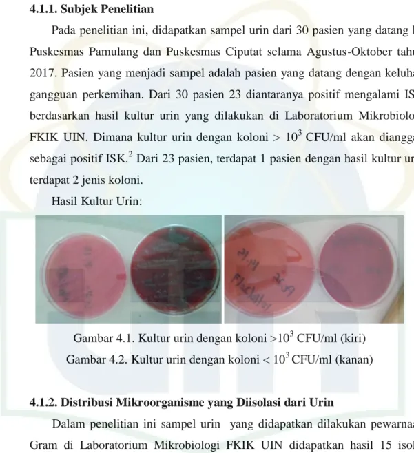Gambar 4.1. Kultur urin dengan koloni &gt;10 3  CFU/ml (kiri)  Gambar 4.2. Kultur urin dengan koloni &lt; 10 3  CFU/ml (kanan) 
