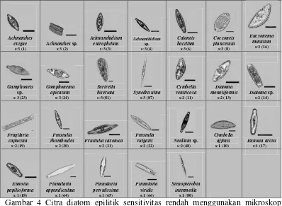 Gambar 4 Citra diatom epilitik sensitivitas rendah menggunakan mikroskop trinokuler Zeiss Primo Star yang dilengkapi perangkat lunak Axio Vision Rel 4.8 (skala batang: 10 µm; s: level sensitivitas) 