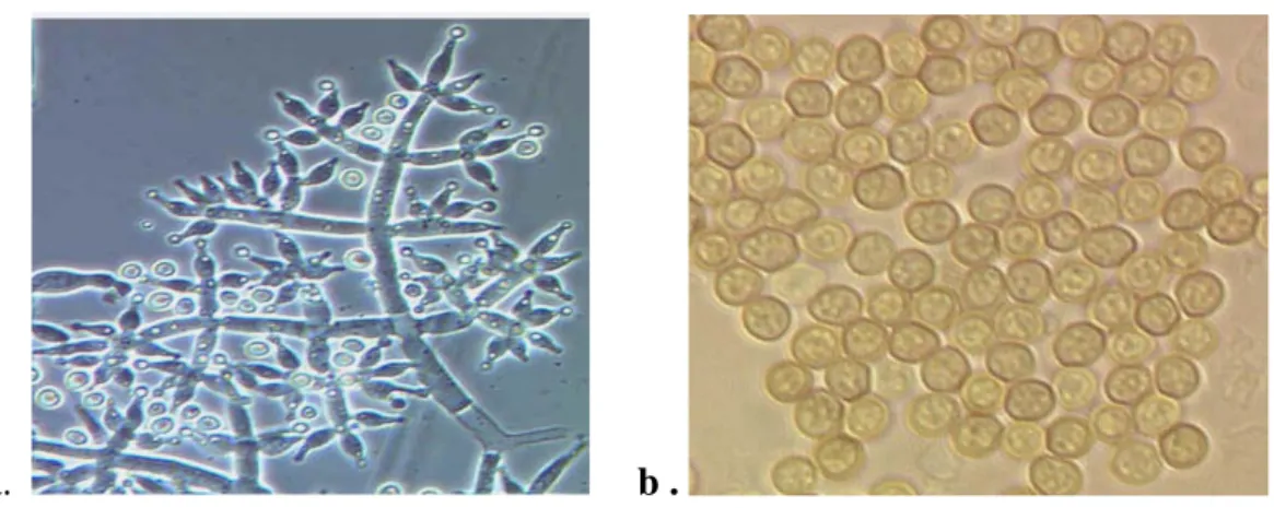 Gambar 5. (a) Konidiofor jamur  T. harzianum    (b) Konidia T. Harzianum. 