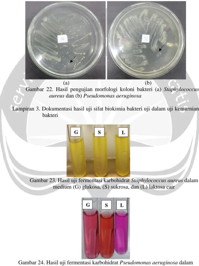 Gambar  22.  Hasil  pengujian  morfologi  koloni  bakteri  (a)  Staphylococcus  aureus dan (b) Pseudomonas aeruginosa 