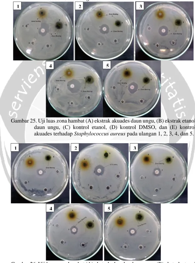 Gambar 25. Uji luas zona hambat (A) ekstrak akuades daun ungu, (B) ekstrak etanol  daun  ungu,  (C)  kontrol  etanol,  (D)  kontrol  DMSO,  dan  (E)  kontrol  akuades terhadap Staphylococcus aureus pada ulangan 1, 2, 3, 4, dan 5