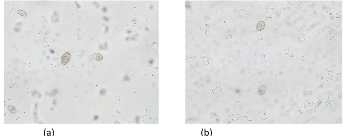 Gambar  1.  Ookista  Eimeria  sp.  kelinci  yang  terinfeksi  koksidiosis  di  Karanggintung,  Kabupaten Banyumas (a) belum bersporulasi dan (b) bersporulasi