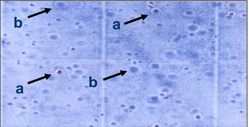Gambar 2. Perbandingan sel kanker hidup dan mati (a) sel hidup dan (b) sel mati. 