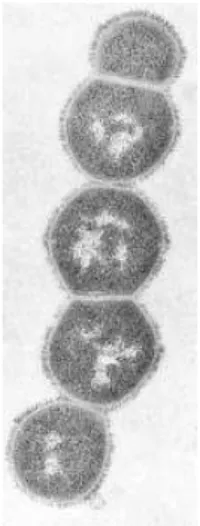 Gambar 1. Bakteri Streptokokus