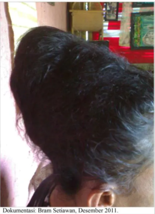 Gambar  1:  Gambar  di  atas  adalah  bentuk  dari  rambut  gimbal  alami  (bok  gempel) milik Purnomo Agus Sularso