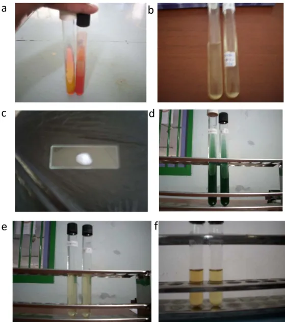Gambar 5. Hasil uji fisiologi isolat bakteri dari limbah sago. a. media TSIA,  b. Hasil uji pada media gelatin