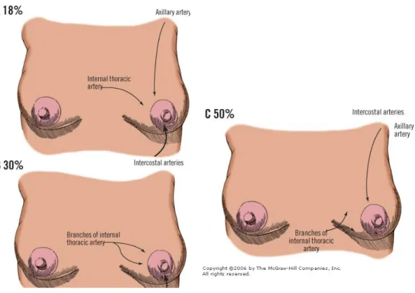 Gambar  1.5.  Dumpling of the breast, akibat dari terlibatnya ligamentum Cooper  pada   penyakit   yang  invasive