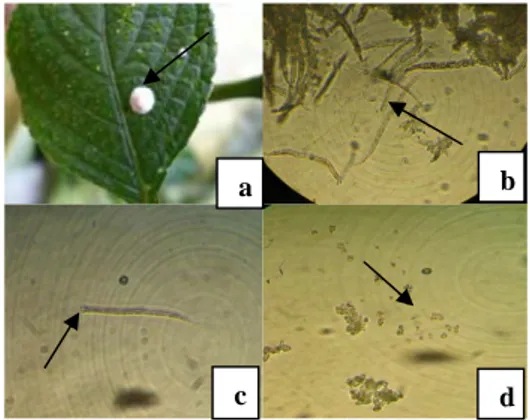 Gambar 4  Hypocrella RA 03 pada (a) permukaan daun  Strobilanthus cernuus, (b) kumpulan askus,  (c) askus dengan tudung askus (cap), dan (d)  kumpulan askospora