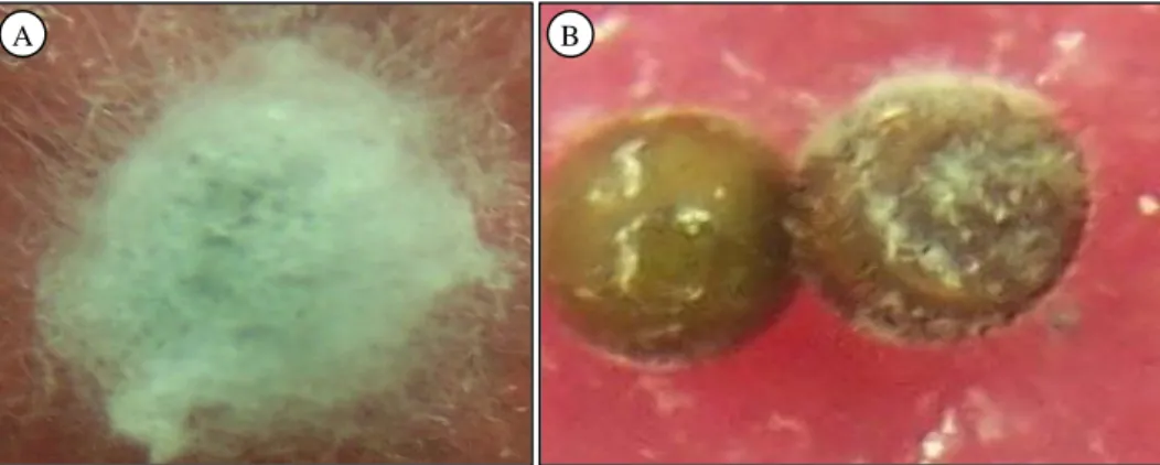 Gambar 1.  Kolonisasi isolat L. lecanii yang virulen (Ll-JTM11). A = dan isolat yang avirulen (Ll-NTB4),  B = pada telur kepik coklat.