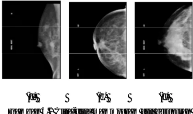 Gambar 3.1 Citra-citra mammogram asli berukuran  3584x4784 